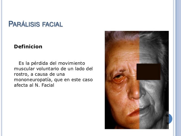 Xl Jennie Louise Voluptuous Pics De Paralisis Facial